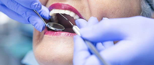 Best Emergency Dental Extractions in Roaming Shores, OH